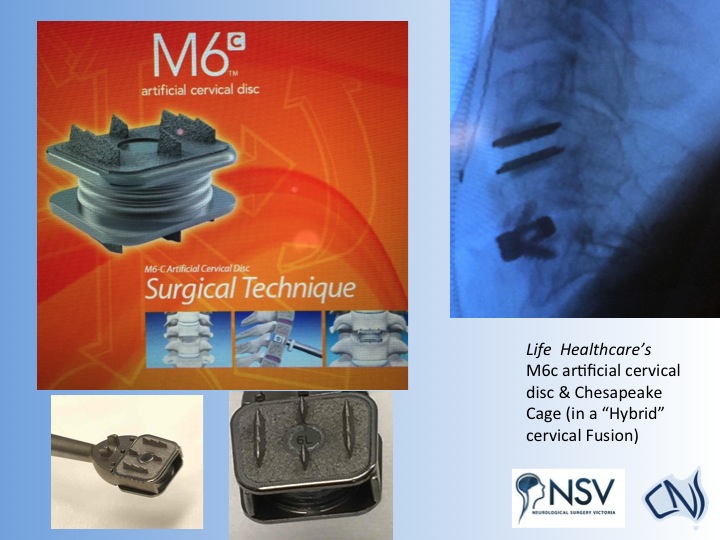 Spinal Instrumentation 4 | C.N.S. Neurosurgery