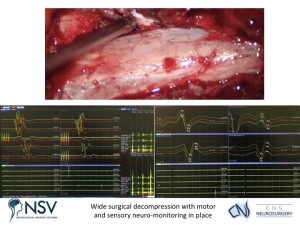 1c. Advanced Spinal