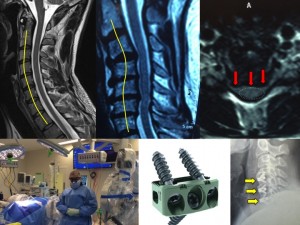 2a. Advanced Spinal